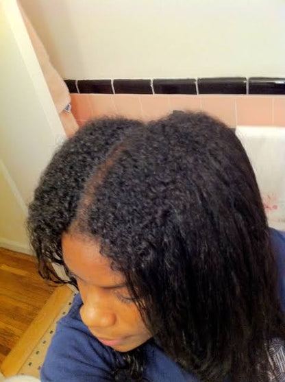 Traitement Repousse Cheveux Minoxidil 5 %
