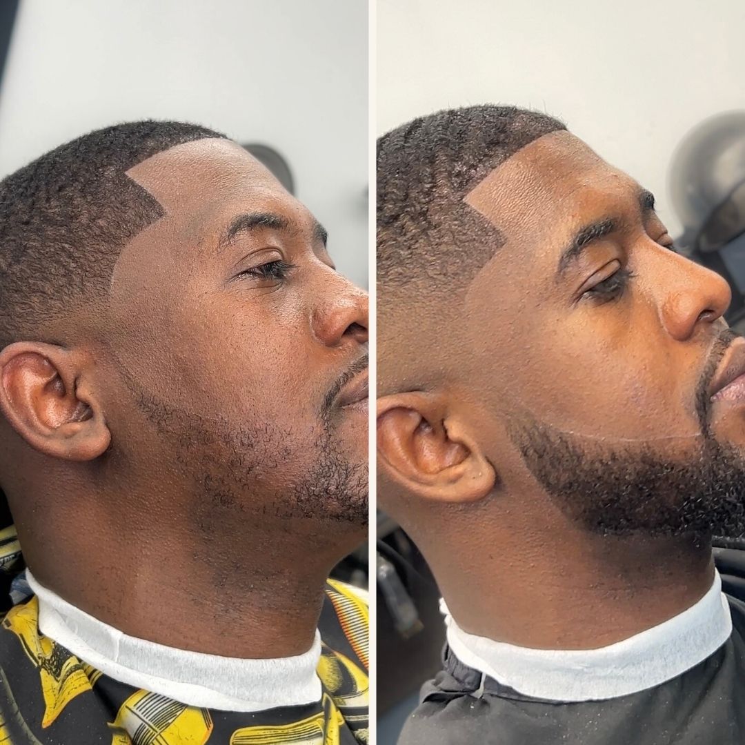Traitement Repousse Cheveux Minoxidil 5 %