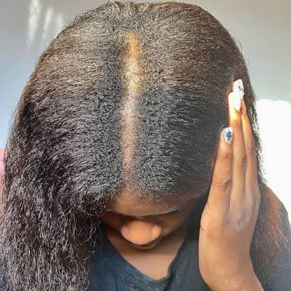 Traitement Repousse Cheveux Minoxidil 5 %