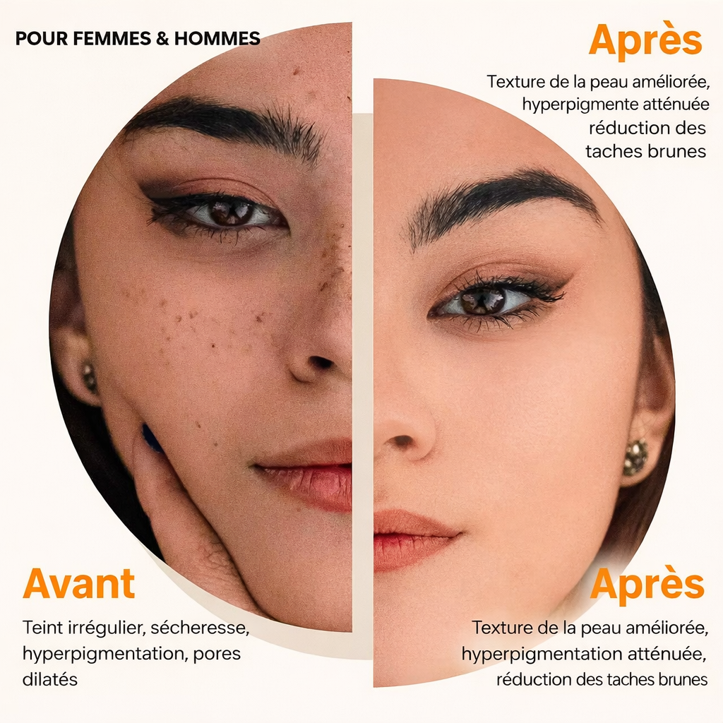 Pack de 3 Savons Éclaircissant à l’Acide Kojie