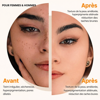 Pack de 3 Savons Éclaircissant à l’Acide Kojie