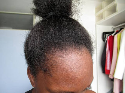 Traitement Repousse Cheveux Minoxidil 5 %